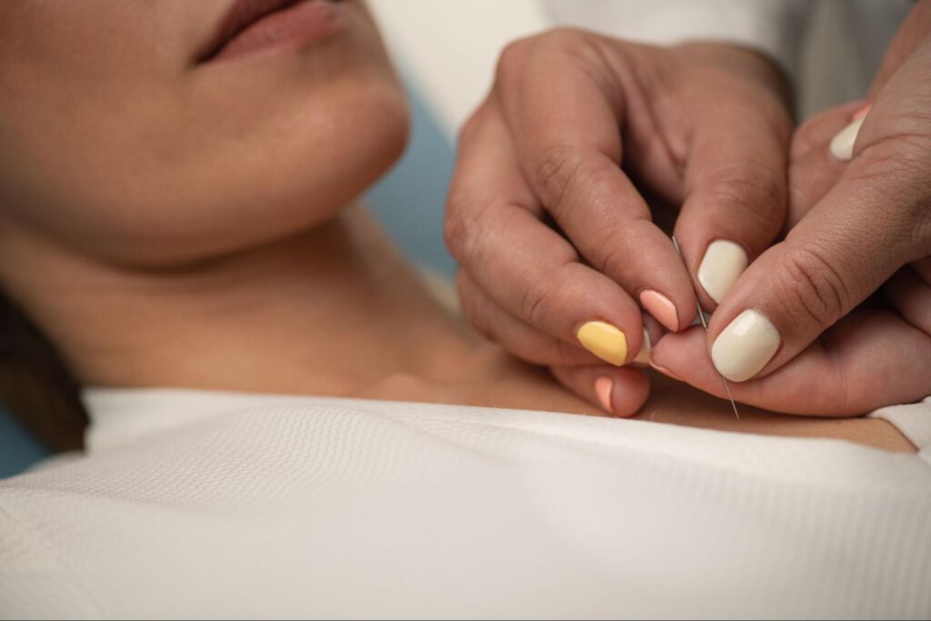 Woman with painted nails administering a needle into a woman for acupuncture.