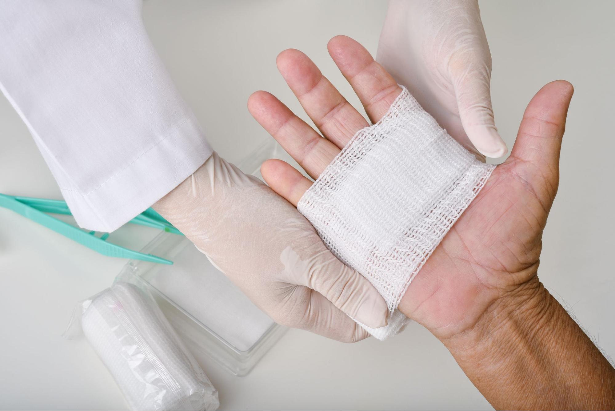 A doctor wearing white gloves using bandages to dress a patient’s hand after wound care.