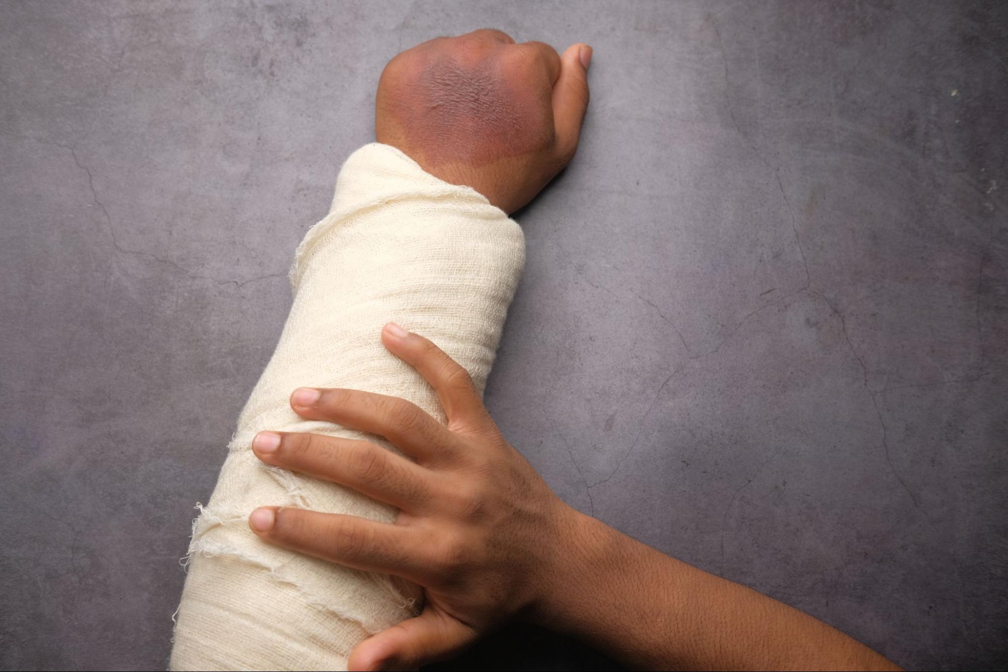 Person with bandage around a wound on their arm. 