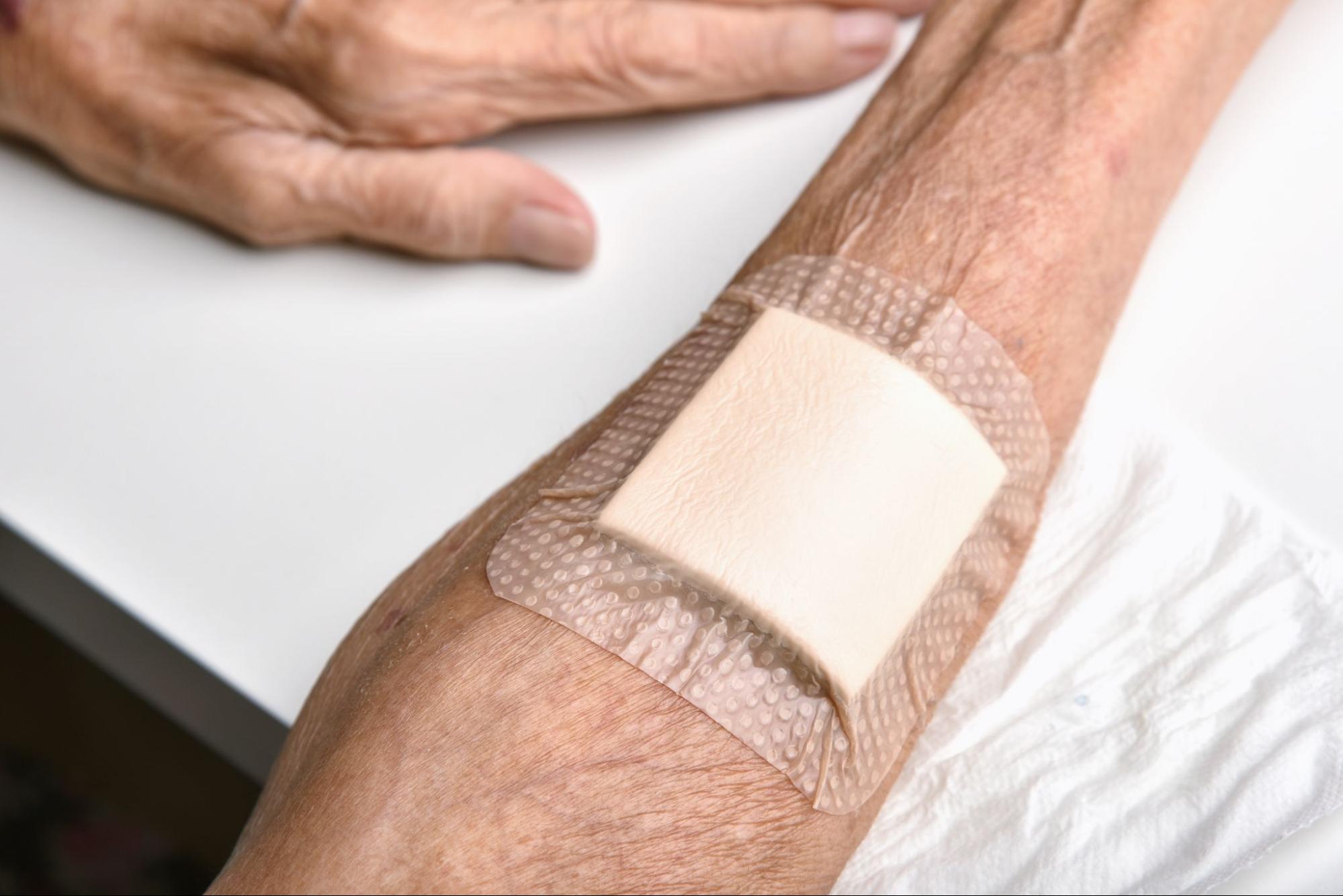 A bandage covering a man’s arm with a chronic wound.