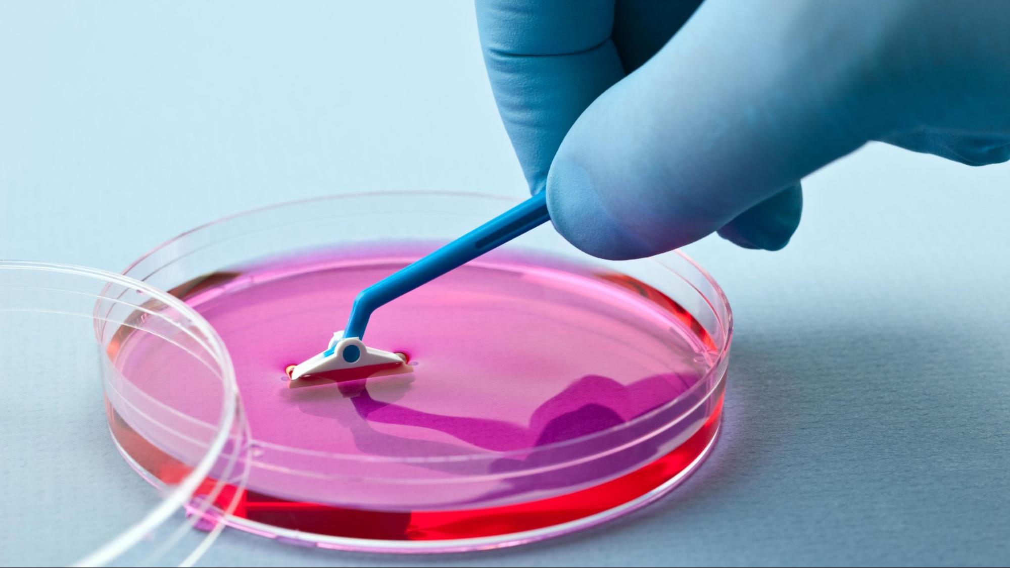 A concept for "What are stem cells?" A close-up of a blue latex gloved hand doing laboratory research on a cell culture.