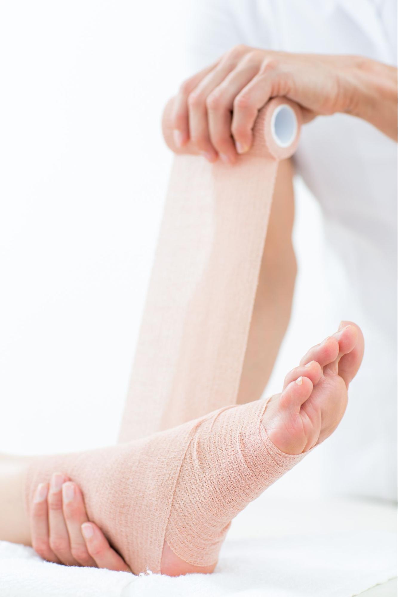A close-up image of a doctor treating pressure ulcer symptoms by bandaging a woman’s foot and heel. 