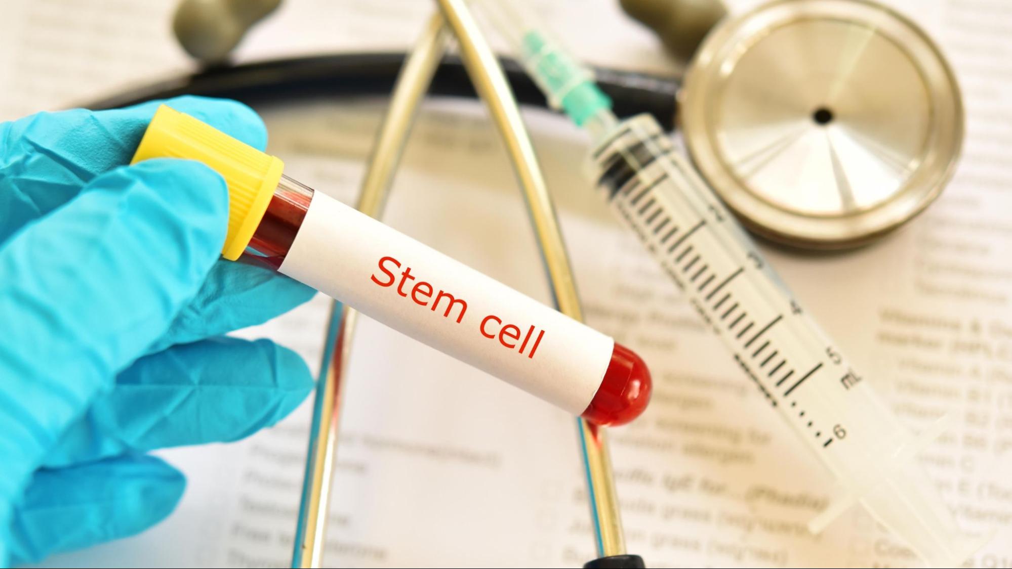 A scientist's gloved hand holds a blood vial with the words "Stem Cell" on it while other medical accessories are in the background.