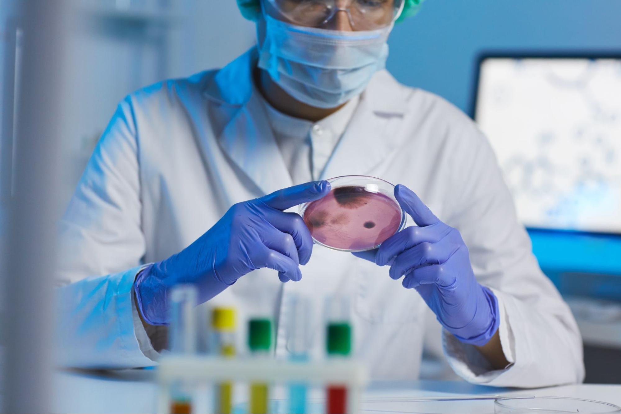 A scientist wearing a white lab coat, blue latex gloves, a mask, and glasses studying a stem cell sample in a petri dish in a lab. A concept for where stem cells are found.